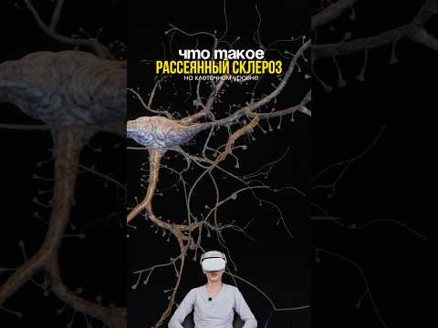 Рассказываю про рассеянный склероз Рассказываю про рассеянный склероз