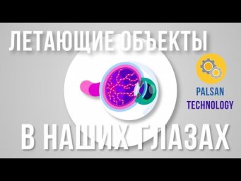 Летающие Объекты В Наших Глазах. Что Такое Летающие Мушки?