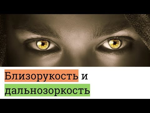Близорукость и дальнозоркость (миопия и гиперметропия). Что это такое?