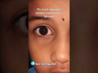 Нистагм -непроизвольные движения глаз #biology #анатомия #нистагм #глаза