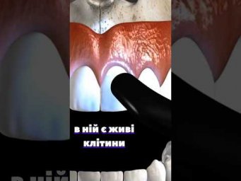 Бережіть свою емаль 