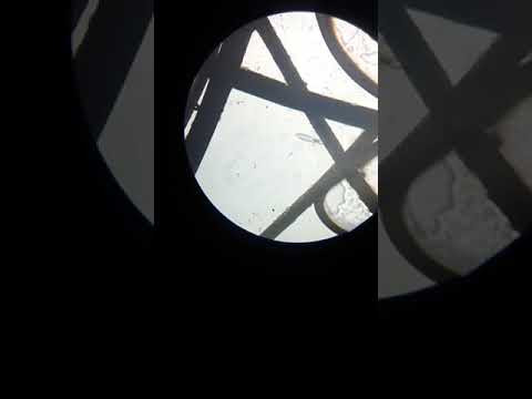 Подкожный клещ Demodex
