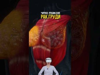 наглядно показала, как выглядит рак на разных стадиях 