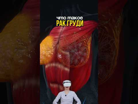 наглядно показала, как выглядит рак на разных стадиях 