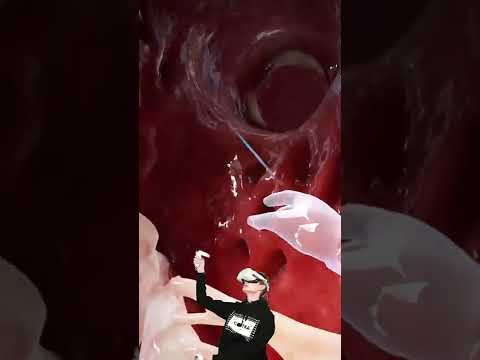 Правый желудочек сердца в онлайн школе Сотка