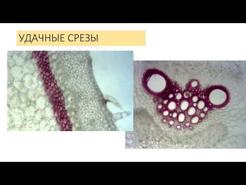 Разбор заданий ЗЭ-2019, Анатомия растений, 10 класс