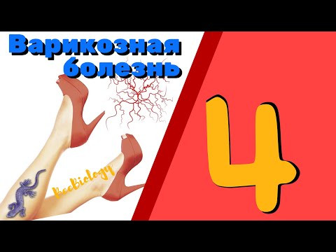 Варикозная болезнь • Варикозное расширение вен нижних конечностей Варикозная болезнь • Варикозное расширение вен нижних конечностей