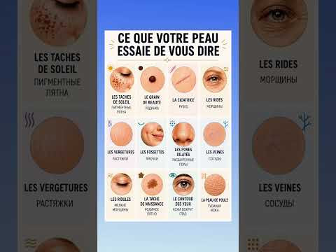 Ce que votre peau essaie de vous dire #французский #французскийснуля #французскийонлайн Ce que votre peau essaie de vous dire #французский #французскийснуля #французскийонлайн