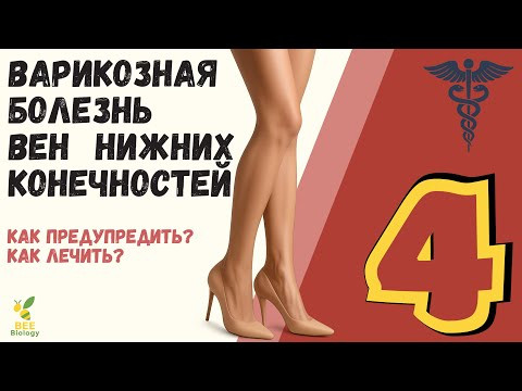 Варикозная болезнь вен ног: причины, симптомы и лечение | Как избавиться от варикоза навсегда Варикозная болезнь вен ног: причины, симптомы и лечение | Как избавиться от варикоза навсегда