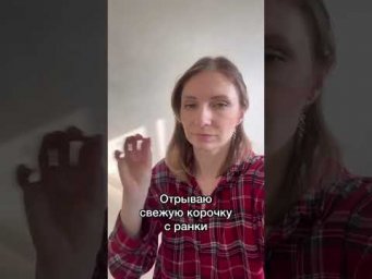 Свертывание крови #биология #егэ2024 #егэ #биологияегэ #анатомия #тромбоциты #гемостаз