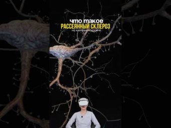 Рассказываю про рассеянный склероз 