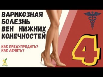 Варикозная болезнь вен ног: причины, симптомы и лечение | Как избавиться от варикоза навсегда