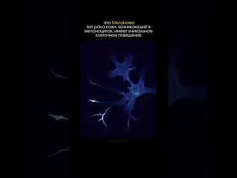 а ты знал о меланоме твоего организма?