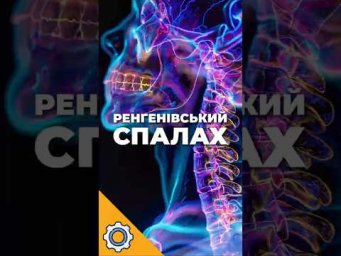 Найближча зоря несподівано спалахнула рентгеном  Що це було
